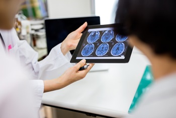 Doctor looking at brain scans